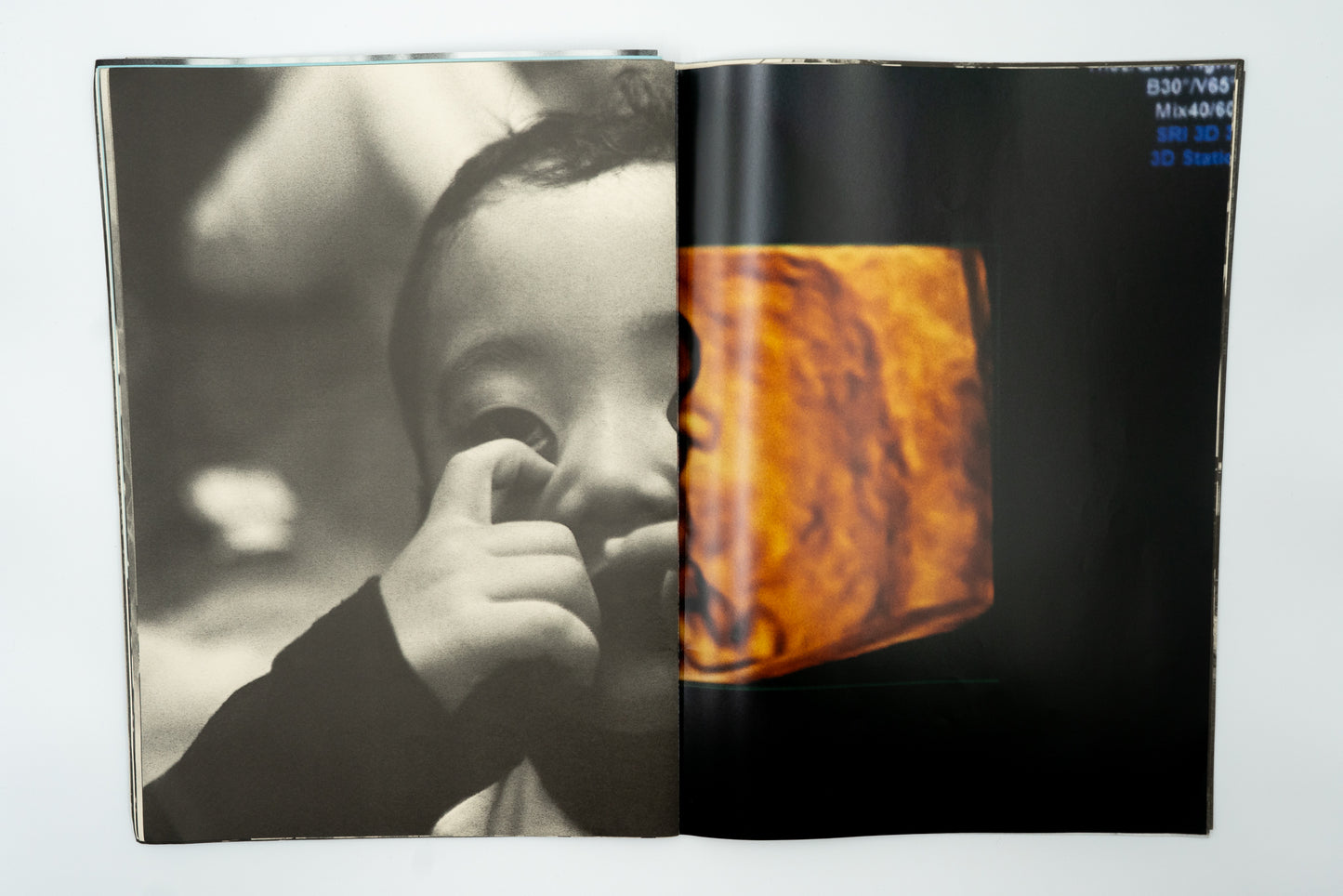 Incipient Strangers｜Yoshikatsu Fujii